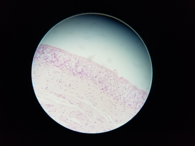 Pseudostratified Epithelium Slides - Pseudostratified Epithelium 05 400X